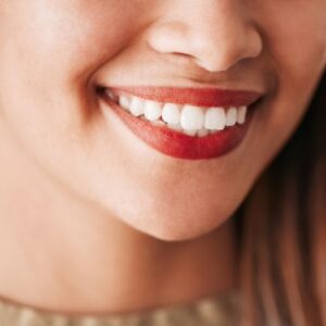 woman with veneers smiling 