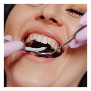 woman getting dental work